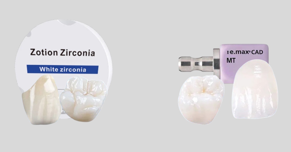 Що краще: цирконій чи E-max?
